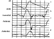 \begin{figure}\begin{center}
\epsfig{file=bild4-24.eps, height=30mm} \par\end{center}\end{figure}