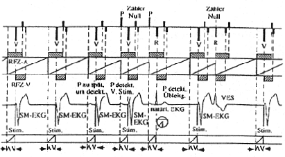 \begin{figure}\begin{center}
\epsfig{file=bild7-27.eps, height=50mm} \par\end{center}\end{figure}