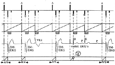 \begin{figure}\begin{center}
\epsfig{file=bild7-32.eps, height=50mm} \par\end{center}\end{figure}
